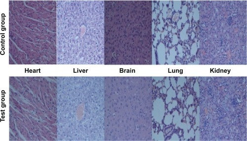 Figure 6 Representative histologic images of the mice treated, respectively, with physiologic saline (control group) and aqueous suspension of the thrombin nanocomplexes (test group) after 7 days. Figure 7 (A) Hemostatic efficacy of thrombin nanocomplexes in rat hepatic hemorrhage model. (B) Hemostatic efficacy of native thrombin in rat hepatic hemorrhage model. (C) Hemostatic efficacy of thrombin nanocomplexes in rat iliac artery hemorrhage model. (D) Hemostatic efficacy of native thrombin in rat iliac artery hemorrhage model.Display full size