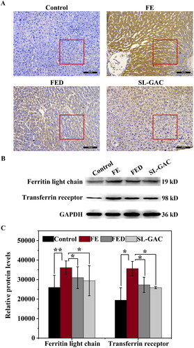 Figure 3. Effects of SL-GAC on protein expression levels involved in iron metabolism. (A) Immunohistochemistry against ferritin in liver tissue samples of mice. (B, C) Protein levels of ferritin light chain and transferrin receptor in the liver of different groups as determined by immunoblotting (n > 5). Results were normalized to the internal control GAPDH and presented as relative expression level calculated.
