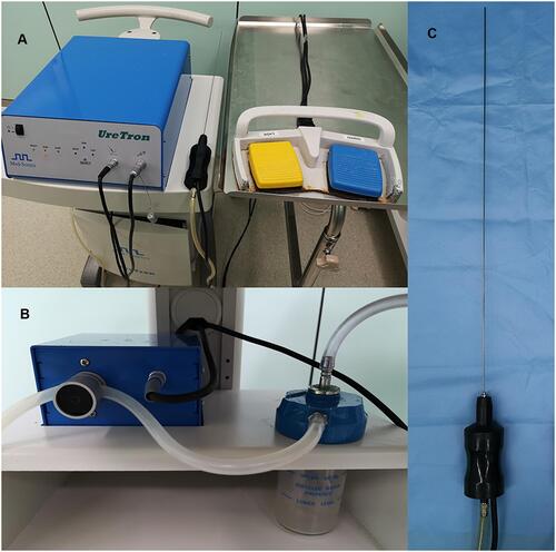 Figure 1 The UreTron single probe ultrasonic intracorporeal lithotripsy system. ((A) Equipment composition and connection status; (B) Negative pressure drainage and stone powder recovery device; (C) The single-handle, single probe lithotripsy rod suitable for ureteroscopic lithotripsy).