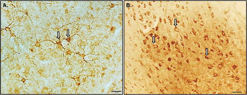 Figure 1. Photomicrographs illustrating the different doublecortin positive (DCX+) cell types observed in the cowbird hippocampus (Hp). As described in Boseret et al. (Citation2007), four types of DCX cells can be observed in the songbird brain: (1) densely stained round multipolar cells, (2) fusiform elongated cells, (3) weakly stained round cells with few immunolabelled processes detected, and (4) weakly stained cells associated with punctate structures. (A) Densely stained round multipolar cells with labelled neurites were observed only against the midline of the Hp near the ventricle dividing Hp from neostratium, and (B) weakly stained round cells with few immunolabelled processes detected were also observed in all sub-regions of Hp. The white arrows indicate the types of cells counted in this study. Photomicrographs were taken using a 40× objective. Scale bars = 20 µm.