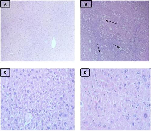 Figure 2 Photomicrographs of H&E stained liver sections of mice. (A) Group I. (B) Group II – liver sections present severe degenerative changes in hepatocytes including fatty changes (arrows). (C) Group III. (D) Group IV.