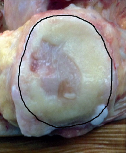 Figure 2. Delineation of the perimeter of the articular surface of the patella.