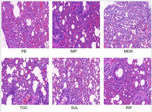 Figure 2 Pulmonary histopathology of the monotherapy group after 48 h of treatment (hematoxylin-eosin staining, ×200).