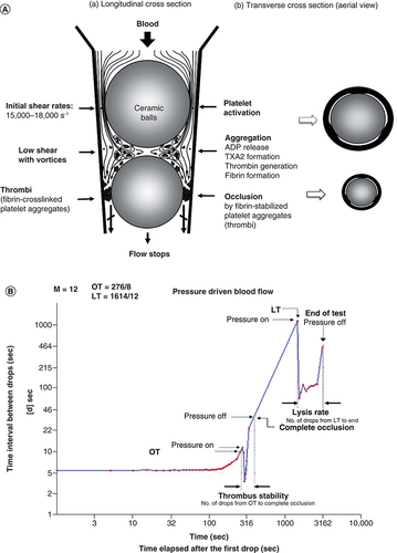 Figure 4. Global thrombosis test.(A) Principle of ex vivo GTT. Platelets are activated under high shear condition at the upper gaps created along the inner of a conical plastic tube. Activated platelets form fibrin-stabilized platelet aggregates under low shear condition between two balls. Fibrin-stabilized platelet aggregates occlude the lower gaps. (B) Pattern obtained by GTT (GTT-3).GTT: Global thrombosis test; LT: Lysis time OT: Occlusion time.
