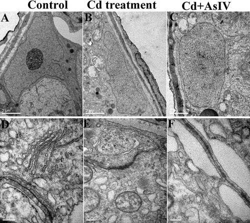 Figure 3. Transmission electron microscopy images of Sertoli cells and tight junctions of the BTB. In the control group, the Sertoli cells adhered to the basement membrane of the seminiferous tubule, and their nuclei were pyramidal, large, and irregular, with nuclear envelopes that were deeply sunken (A). At high magnification, the tight junctions of the BTB remained intact, which appeared as a dense line with high electron density (D). In the Cd group, the cytoplasmic lysis region of the Sertaaaaoli cells was obvious, and vacuoles appeared in the cytoplasm of some Sertoli cells, with swelled mitochondria and myelin-like structures (B). Under high magnification, numerous local gaps in the tight junctions in the BTB were enlarged, and the endoplasmic reticulum in the specialization area expanded significantly (E). In the Cd&AsIV group, the ultrastructural damage to the sertoli cells and the tight junctions of the BTB were weaker compared to the Cd group (C, F)