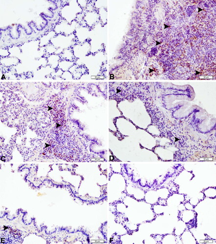 Figure 5. Expressions of IL-1β in lung tissues of septic rats (magnification 40×). (A) Lung tissue of the control group with negative IL-1β protein expression (IHC-P, bar = 50 µm). (B) Lung tissue of the CLP group with very severe IL-1β protein expression (arrowheads) (IHC-P, bar = 50 µm). (C) Lung tissue of the SBR1 group with severe IL-1β protein expression (arrowheads) (IHC-P, bar = 50 µm). (D) Lung tissue of the SBR2 group with moderate IL-1β protein expression (arrowheads) (IHC-P, bar = 50 µm). (E) Lung tissue of the SBR3 group with mild IL-1β protein expression (arrowhead) (IHC-P, bar = 50 µm). (F) Lung tissue of the SBR group with negative IL-1β protein expression (IHC-P, bar = 50 µm).