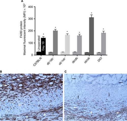 Figure 7 Flap macrophage quantification and localization in lean and obese mice.