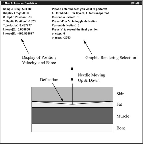 Figure 1. Needle insertion simulator graphical user interface showing layer deflection for visual feedback.