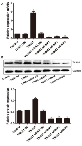 Figure 1 Expression of TNKS1 in U251 cells following transfection with overexpression and siRNA vectors: (A) relative mRNA level, and (B) representative Western blots (upper panel) and relative protein level (lower panel). * denotes P < 0.05 vs control.