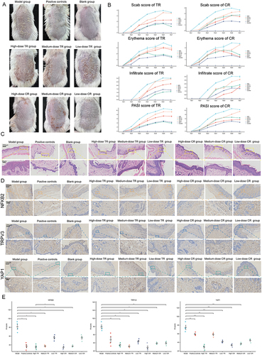 Figure 7 Identification of the Mechanisms of Cinnamomi Ramulus (CR) and Tripterygii Radix (TR) in the Treatment of Psoriasis. (A) Representative photographs of the back of each group of mice. (B) Scab/Erythema/Infiltrate/psoriasis area severity index (PASI) score of each group for day1, day2, day3, day4, day4, day5, day6 and day7. Left: TR, Right: CR. (C) Skin lesions of each group were stained with HE (Magnification × 10, scale bars = 250 µm; Magnification  × 40, scale bars = 50 µm). (D) Skin lesions of each group were stained with NFKB2, TRPV3, YAP1 (Magnification × 10, scale bars = 250 µm; Magnification  × 40, scale bars = 50 µm). See also Figure S10. (E) Differences of NFKB2, TRPV3, YAP1 immunohistochemical staining intensity among nine groups as assessed by H-score (n = 4). One-way ANOVA was conducted. *P < 0.05, **P < 0.01, ***P < 0.001. Model, imiquimod; Low dose, 0.585 g/kg/day; medium dose, 1.17 g/kg/day; high dose, 2.34 g/kg/day. See also Figure S11.