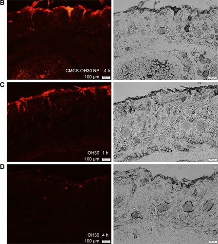 Figure 5 Distribution of CMCS-OH30 NP in the nude mouse skin tissue observed by fluorescence microscope.Notes: Images of CMCS-OH30 NP at 1 h (A) and 4 h (B) posttreatment; images of free OH30 at 1 h (C) and 4 h (D) posttreatment. OH30 used was labeled with Cy5 (red).Abbreviation: CMCS-OH30 NP, carboxymethyl chitosan nanoparticles.