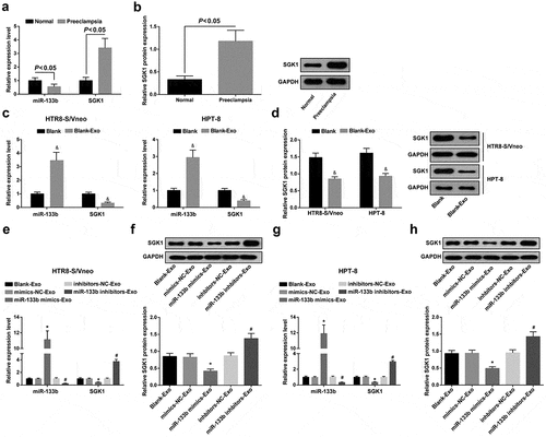 Figure 2. MiR-133b is downregulated and SGK1 is upregulated in placental tissues of PE patients; miR-133b expression is inversely related to SGK1 expression in HTR8-S/Vneo and HPT-8 cells co-cultured with hUC-MSC-derived exosomes. a. Detection of miR-133b and SGK1 mRNA expression in placental tissues of PE patients and normal pregnant women by RT-qPCR; b. Detection of SGK1 protein expression in placental tissues of PE patients and normal pregnant women by Western blot analysis; c. Detection of miR-133b and SGK1 mRNA expression in HPT-8 cells and HTR8-S/Vneo cells after normal culture and co-culture with exosomes; d. Detection of SGK1 protein expression in HPT-8 cells and HTR8-S/Vneo cells after normal culture and co-culture with exosomes; e. Detection of miR-133b and SGK1 mRNA expression of HTR8-S/Vneo cells cultured with exosomes in each group by RT-qPCR; f. Detection of SGK1 protein expression of HTR8-S/Vneo cells cultured with exosomes in each group by Western blot analysis; g. Detection of miR-133b and SGK1 mRNA expression of HPT-8 cells cultured with exosomes in each group by RT-qPCR; h. Detection of SGK1 protein expression of HPT-8 cells cultured with exosomes in each group by Western blot analysis; &, P < 0.05 vs the Blank group; *, P < 0.05 vs the mimics-NC-Exo group; #, P < 0.05 vs the inhibitors-NC-Exo group; the data in the figure were all measurement data expressed as mean ± standard deviation; comparison between two groups were analyzed by independent sample t-test, and that among multiple groups by one-way ANOVA, after which pairwise comparison was performed with Tukey’s multiple comparisons test.