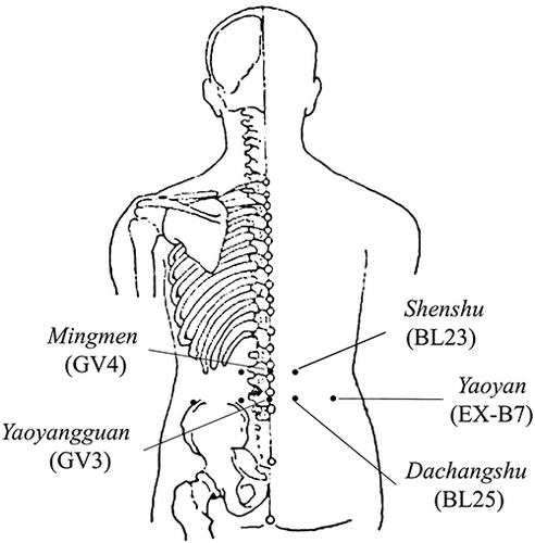 Figure 2 Locations of acupoints. Shenshu (BL23): On the back, 1.5 cun lateral to the lower border of the spinous process of the 2nd lumbar vertebra. Dachangshu (BL25): On the back, 1.5 cun lateral to the lower border of the spinous process of the 4th lumbar vertebra. Mingmen (GV4): In the lumbar region, on the posterior median line, in the depression below the spinous process of the 2nd lumbar vertebra. Yaoyangguan (GV3): On the lumbar region, on the posterior median line, in the depression below the spinous process of the 4th lumbar vertebra. Yaoyan (EX-B7): On the lower back, in the depression 3.5 cun lateral to the lower border of the spinous process of the 1st lumbar vertebra.