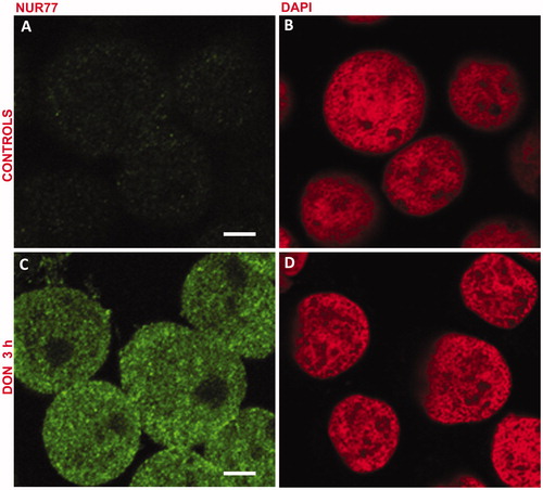 Figure 5. DON induces NUR77 expression. Jurkat cells were treated with 0.5 μM DON for 3 h. (A, B) untreated; (C, D) treated. (A, C) NUR77 staining; (B, D) DNA staining with DAPI. Scale bar: 7 μm.