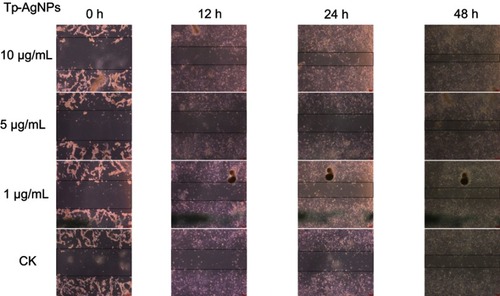 Figure 5 Wound healing effect of the Tp-AgNPs in NIH3T3 cells at different time intervals.Abbreviations: CK, control group; Tp-AgNPs, Talaromyces purpureogenus silver nanoparticles; NIH3T3, Swiss albino mouse embryo tissue.