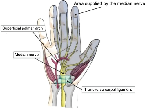 Figure 1 The carpal tunnel is a passageway through which nine flexor tendons and the median nerve pass in order to supply function, feeling, and movement to the thumb, index, middle and half of the ring finger.