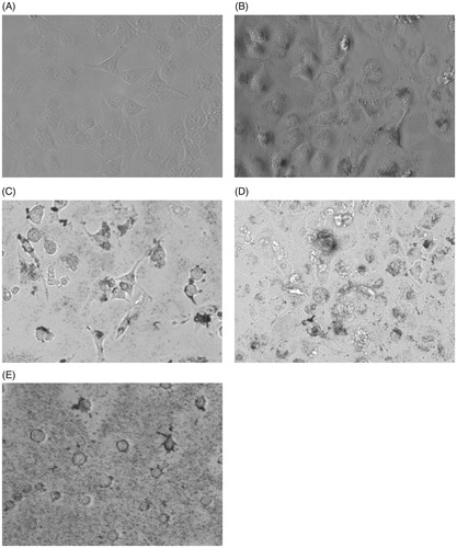 Figure 9. Cell morphology of HeLa cells with different concentrations of Au. (A) 0 μg/mL, (B) 16 μg/mL, (C) 32 μg/mL, (D) 63 μg/mL and (E)126 μg/mL.