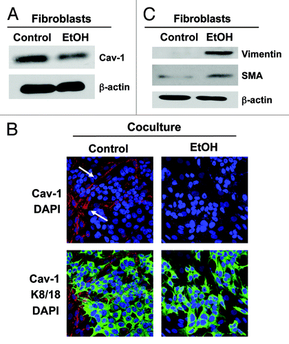 Figure 1. Ethanol induces Cav-1 downregulation and myofibroblastic differentiation in the stromal fibroblast compartment. (A) Fibroblasts were cultured for 2 d. To study the effect of ethanol (EtOH), cells were cultured in the presence or in the absence of 100 mM EtOH for additional 72 h. Western blot analysis using antibody directed against Cav-1. Note that EtOH exposure induces a downregulation of Cav-1 in fibroblasts. β-actin was used as equal loading control. (B) Immunofluorescence. MCF7 cells were co-cultured with fibroblasts for 2 d and treated with 100 mM EtOH for additional 72 h. Then, cells were fixed and immunostained with antibody probes against Cav-1 (red, upper panels) and keratin-8/18 (K8/18, green, lower panels). Nuclei were counterstained with DAPI (blue). K8/18 staining is specific for MCF7 cells and Cav-1 is specific for fibroblasts, since MCF7 cells lack Cav-1 expression. Note that Cav-1 expression is downregulated in the fibroblast compartment after ethanol treatment, relative to untreated cells. Original magnification, 40x. (C) Fibroblasts were allowed to growth for 2 d, and then were cultured in the presence or in the absence of 100 mM EtOH for 72 h. Western blot analysis using antibodies against vimentin and SMA. β-actin was used as equal loading control. Note that ethanol-treated fibroblasts display an upregulation of the myofibroblast markers SMA and vimentin.