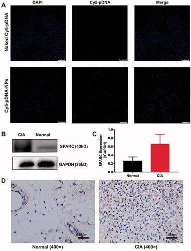 Figure 2. Active targeting study of pDNA/DSP-NPs. (A) Uptake of naked Cy5-pDNA and Cy5-pDNA-NPs by RAW264.7 cells with LPS activation. Scale bar, 75 μm. (B) Western blotting (WB) assay of SPARC expression in normal and CIA rats. (C) The expression of SPARC was quantitatively analyzed by ImageJ. Results were presented as mean ± SD (n = 3). (D) Immunohistochemical (IHC) staining assay of SPARC expression in normal and CIA rats.