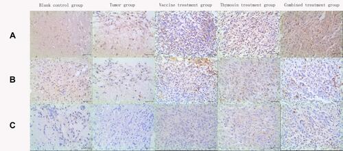 Figure 11 Immunohistochemical images of the abundance of (A) CD4+ T cells, (B) CD8+ T cells, and (C) CD161+ natural killer (NK) cells in rat tumor tissues for the five treatment groups.