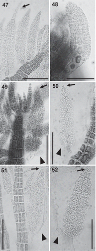 Figs 47–52. Spermatangial branches in the Polysiphonieae. Replacing trichoblasts and with sterile apical filaments in Polysiphonia stricta (Fig. 47, Polysiphonia sensu stricto clade 1). Replacing trichoblasts and lacking sterile apical cells in Vertebrata lanosa (Fig. 48, Vertebrata clade). On a branch of a trichoblast and with sterile apical cells in P. fucoides (Fig. 49, Vertebrata clade), P. denudata (Fig. 50, Carradoriella clade), P. schneideri (Fig. 51, ‘P.’ schneideri clade) and Neosiphonia harveyi (Fig. 52, Melanothamnus clade). Scale bars: 100 µm. Arrows show the apical sterile cells and arrowheads the sterile branch of fertile trichoblasts.