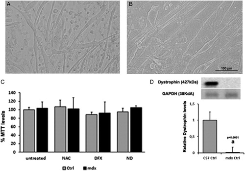 Figure 1. Morphology of normal (A) and dystrophic (B) myotube cultures. In (C), cell viability was assessed by measurement of MTT assay in the muscle cells from C57BL/10 mice (Ctrl) and mdx mice (mdx). Myotubes were treated for 24 hours with N-acetylcysteine (NAC), deferoxamine (DFX), NAC plus DFX (ND), or did not receive any treatment (untreated). In (D), Immunoblot analysis of dystrophin and graph showing protein level in the muscles cells from C57BL/10 mice (Ctrl) and mdx mice (mdx). Glyceraldehyde-3-phosphate dehydrogenase (GAPDH) was used as a loading control. All the experiments were performed in triplicate, and; the relative value of the band intensity was quantified and normalized by the corresponding Ctrl. ‘a’ versus Ctrl. Error bars, SD.