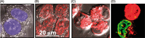 Figure 4. Fluorescence images of A2780 cells. (A) Cells were incubated with Hoechst 33258 to reveal the location of cell nuclei. (B) Cells were incubated with a DOX hydrochloride dissolved in the culture medium; DOX accumulated in cell nuclei. (C) Cells were incubated with hydrophobised DOX encapsulated in PEG-PCL micelles; DOX was internalised by the cells but did not penetrate into cell nuclei. (D) A confocal image of cells sonicated in the presence of DOX encapsulated in PEG-PCL micelles; ultrasound enhanced DOX penetration into cell nuclei but the effect was not uniform. Some small fraction of cells was pre-incubated with Hoechst 33258; Hoechst fluorescence colour was artificially changed to green in order to reveal DOX penetration into cell nuclei by the generation of yellow colour. Adapted from Mohan and Rapoport Citation[99] with permission from ACS Publishing.
