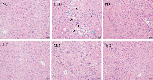 Figure 4. Liver histological image of mice. (The black arrow represents lipid droplet vacuoles of varying sizes within liver cells. The blue arrow represents an inflammatory cell lesion found in the liver tissue.).