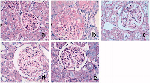 Figure 1. Renal histology in PAS-stained sections (400 ×). Notes: (a) Sham operation group; (b) control group; (c) low protein diet group; (d) AST-120 group; and (e) AST-120 + LPD group. The kidney tissue of AD + LPD, LPD and AD rats are with less proliferation of mesangial cells, increase area and inflammatory cell infiltration of interstitial substance and protein cast compared with ctrl rats. No focal segmental sclerosis and adhesion of glomerulus and capsule was observed (Figure 4a–e).