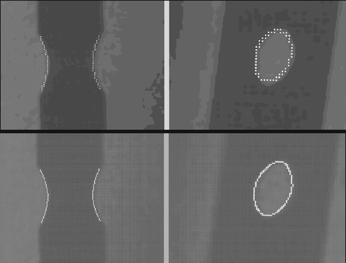 Figure 10. The DLH edges extracted with different degrees of precision. Top: Edges extracted by applying a Canny edge detector without interpolation of the underlying sub-images. Bottom: Edges extracted by applying a Canny edge detector with interpolation of the underlying sub-images.
