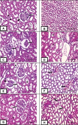 Figure 4 H&E staining of renal sections.Notes: (A,B) Photo micrograph of renal sections of control group showing normal Malpighian corpuscle with normal glomerulus (arrow) surrounded by Bowman’s capsule (arrow head). cortical tubules are of normal architecture (star) and medullary tubules showing normal vasculature. (C–F) Photomicrograph of renal sections of methotrexate treated group showing marked loss of normal glomerular architecture with glomerular collapse (arrow), dilated capsular space full of vacuolated acidophilic material (arrowhead). Tubular epithelial cells showing cytoplasmic vacuolation, pyknotic nuclei with some of them are exfoliated (star). Marked cellular infiltration are also observed (angled arrow). Medullary peritubular blood capillaries are dilated and congested (notched arrow). (G,H) photomicrograph of renal sections of group III showing preserved cortical architecture with normal Malpighian renal corpuscle (arrow) and normal cortical tubules except for some tubular vacuolations (star). Medullary peritubular blood capillaries showing mild congestion (notched arrow). Magnification: (A–H) ×400, scale bar =25µm.
