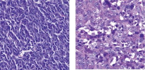 Figure 4. Microphotographs of section from SCID mouse tumors of HT1080 cells (left column) and the pFUS-DDIT3EGFP-transfected variant (right column).