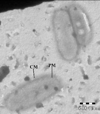 Figure 6. Transmission electron micrographs of untreated E. coli cells. CW = cell wall; PM = plasma membrane.