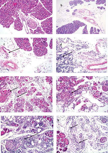 Figure 5. Histopathological changes in the pancreatic tissues of the virus challenged pups of CVB4-E2 infected and pups of mock control dams.(a) Absence of changes in the acinar and endocrine pancreatic tissue (20×) dam infected on day 4/E.4 of gestation and virus challenged pup sacrificed on day 5. (b) Peripancreatic fat tissue (20×) of a mock-infected dam on day 4/E.4 of gestation and (−/−) pup mock challenged and sacrificed on day 5 p.i. (c) Mild and severe (d) forms of infiltration in the peripancreatic fat tissue of a virus challenged two different pups (−/+) of a dam mock-infected on day 4/E.4 of gravidity (20×), pups sacrificed on day 5 p.i. (20×). (e) Chronic pancreatitis and atrophy of the acinar tissue of a challenged pup (+/+) sacrificed on day 5 p.i. born to dam infected with virus on day 10/E.10 of gravidity, (f) chronic pancreatitis and atrophy of the acinar tissue and infiltration in the endocrine islet of a challenged pup (+/+) sacrificed on day 21 p.i. (20×) born to dam infected with the virus on day 10/E.10 (20×) in the tissue of pup sacrificed on day 21 p.i., (g) chronic pancreatitis in the acinar tissue of the virus challenged pups (+/+) of dam infected on day 17/E.17 of gestation day, pup sacrificed on day 12 p.i., absence of infiltration of the islets (20×), (h) chronic pancreatitis and atrophy in another challenged pup (+/+) sacrificed on day 12 p.i. (20×) of dams infected on day 17/E.17 of gestation day.