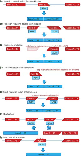 Figure 2. Antisense mediated exon skipping for various mutation types. (a) Antisense oligonucleotides (AONs) can hybridize to a target exon during the pre-mRNA splicing process. This will hide the target exon from the splicing machinery, and it will be spliced out with its flanking introns. For a deletion of exon 52, the skipping of exon 51 will restore the reading frame, to allow the production of a Becker-type dystrophin rather than a non-functional dystrophin. (b) Double exon skipping for a deletion mutation. For most deletions the reading frame can be corrected by skipping a single exon (see Figure 2). Some deletions however, such as a deletion of exon 46–50, required the skipping of both flanking exons to restore the reading frame. (c) Exon skipping for a splice site mutation. Most splice site mutations, will cause a single exon deletion on mRNA level (a 3ʹ splice site mutation in intron 44 results in exon 45 no longer being recognized by the splicing machinery in this example). Like with exon deletions, skipping additional exons (exon 46 in this example) can restore the reading frame. (d) Single exon skipping for small mutations. When small mutations are located within an in-frame exon, skipping this exon will bypass the mutation, while maintaining the reading frame. In this example, a 1 basepair insertion in exon 42 disrupts the reading frame. Skipping exon 42 bypasses the frame-disrupting mutation. (e) Double exon skipping for small mutations. When small mutations are located within out-of-frame exons, the mutation containing exon needs to be skipped as well as a flanking exon, to bypass the mutation without affecting the reading frame. In the example a nonsense mutation in exon 56 requires the skipping of both exon 56 and exon 57. (f) Exon skipping for single exon duplications. Single exon skipping for single exon duplications allows restoration of the normal transcript when either the original or duplicated exon is skipped (left panel). However, double exon skipping will lead to an out of frame transcript (right panel). (g) Exon skipping for cryptic splicing mutations. Deep intronic mutations can activate splice sites, leading to the inclusion of part of an intron into the mRNA. These cryptic exons often are out-of-frame and/or contain stop codons. Targeting the cryptic exon with an AON can restore the normal transcript.