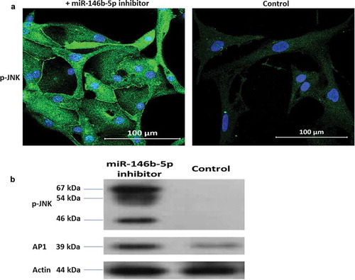 Figure 4. Effect of miR-146b-5p inhibition on the expression of phospho-JNK. (a) Nuclear/cytoplasmic p-JNK (Green) is detected in thyroid cells transfected with miR-146b-5p inhibitor while control cells are negative. (b) Immunoblot showing protein expression of p- JNK (three isoforms of 46, 54 and 67 kDa) and AP1 (39 kDa) in thyroid cells transfected with miR-146b-5p inhibitor with less or no expression in cells transfected with negative control.