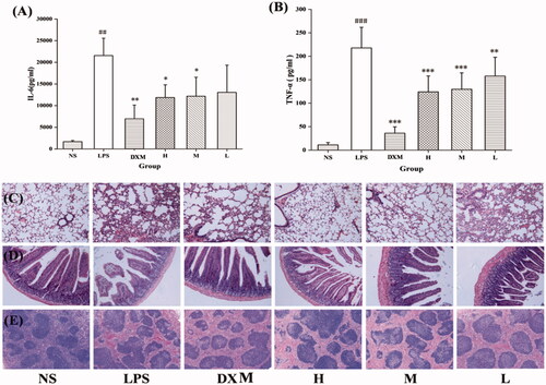 Figure 7. Effects of mulberry silkworm cocoon-derived carbon dots (MSC-CDs) on cytokine levels and pathological features in mice. Effect on (A) IL-6 and (B) TNF-α. Effect on histopathological damage of (C) lungs, (D) small intestine, (E) spleen. Groups (n = 6 each): normal control (NS), model (LPS), DX (0.67 KU/kg), and different doses of MSC-CDs (1.4, 0.7, and 0.35 mg/kg). *p < .05; **p < .01, and ***p < .001 compared with model group; ##p < .01 and ###p < .001, compared with NS group.