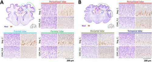 Fig. 7 Neurodepletion in all other lobes following IU inoculation of ZIKV.Nissl and neurofilament (NF)-stained cross-sections of the cerebral cortical lobes at the striatum a and thalamus b of other inoculated fetuses presenting neurodepletion. The various cerebral lobes are indicated. For reference, images are included which are derived from similar cross-sections and from the same cerebral lobes of negative control fetuses. NF neurofilament