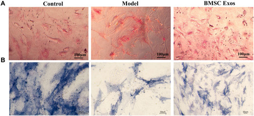 Figure 6 BMSC Exos regulated osteogenic differentiation of steroid-induced BMSCs. (A) Oil red O staining showed significant increase in lipid droplets in BMSCs from the SONFH model compared to the control group (Scale bars: 100um). (B) ALP staining revealed lower numbers of BMSCs stained blue/purple in the SONFH cellular model than that in the control group, while treatment with BMSC Exos reversed this effect (Scale bars: 50um).