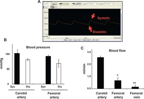 Figure 1 Arterial blood pressure and blood flow. A) A typical femoral arterial wave showing systolic and diastolic peaks. A PE-50 catheter was inserted into femoral artery. B) Bar graphs showed the systolic (sys) and diastolic (dia) blood pressure, measured in the carotid and femoral arteries. C) Bar graphs showed blood flow in different vascular beds.