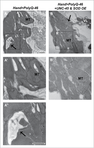 Figure 1. Mitochondrial ultrastructural defects in mutant PolyQ-expressing hearts are suppressed with UNC-45 and SOD overexpression. (A, A′, A″) Cardiac expression of mutant PolyQ-46 resulted in degenerated areas within the cardiomyocyte (arrow), along with fragmentation of mitochondria in cardiomyocytes. MT indicates a fragmented mitochondrion. (B, B’) Combined overexpression of SOD and UNC-45 in PolyQ-46-expressing hearts improved mitochondrial ultrastructure. MT indicates a normally shaped mitochondrion with densely packed cristae. Degeneration (arrow) was reduced to some extent in SOD+UNC-45 overexpressing hearts. VL refers to non-cardiac ventral-longitudinal fibers. Scale bar is 500 nm.