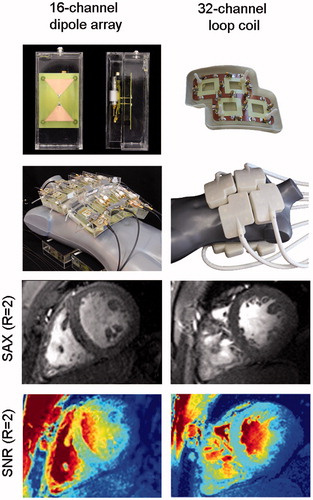 Figure 4. SNR comparison of a 16-channel bow tie dipole array [Citation121] and a 32-channel loop coil array [Citation125] for cardiac imaging at 7.0 T. A 2D CiNE FLASH of a short axis view (SAX) (1.1×1.1×2.5) mm2 and its corresponding SNR map [Citation123,Citation124] is displayed for a GRAPPA reduction factor R = 2. The 16-channel bow tie dipole array shows higher mean SNR values as compared to the 32-channel loop coil indicating its feasibility for MRI at UHF (B0 = 7.0 T) [Citation121]. The excellent image quality obtained from using dipole antennas for MRI demonstrates the rationale of these elements to be used for an integrated system.