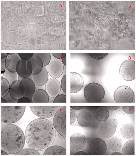 Figure 4. Micrograph images of immobilized E. coli DH5 α (pKAU17) in reaction media at 37 °C at the onset and after 1 h of incubation. (A) (MI)s at t = 0. (B) (MI)s at t = 1 h. (C) (MA)s at t = 0. (D) (MA)s at t = 1 h. (E) (DDMI)s at t = 0. (F) (DDMI)s at t = 1 h.