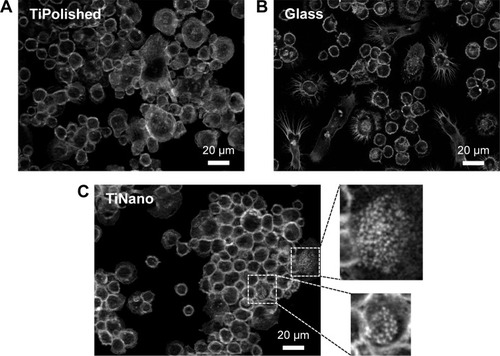 Figure 5 Actin labeling of macrophage on TiPolished (A), Glass (B), and TiNano (C).Note: Enlargement of boxed areas shows podosome formation.Abbreviations: TiPolished, polished titanium; Glass, glass coverslips; TiNano, nanocavitated titanium.
