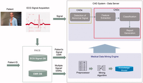 Figure 6. Computer aided diagnosis system for arrhythmia monitoring.