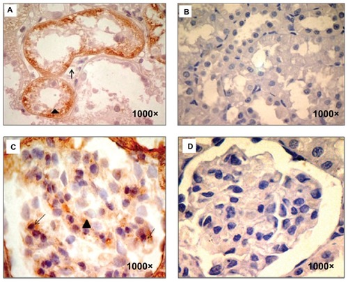 Figure 2 TGF- β1 immunodetection. (A) sStx2-treated rats showing TGF-β1 expression in the basolateral membrane (black arrow) and the cytoplasm (black arrowhead) of renal tubules, (B and D) control rats showed no stain for TGF-β1, (C) sStx2-treated rats showing expression in the mesangium (black arrowhead) and podocytes (black arrow).