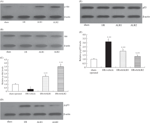 Figure 6. Effects of rhALR treatment on p-Akt and p-p53 expression in kidneys of rats subjected to I/R injury at 24 h. The expression levels of p-Akt (A, C) and p-p53 (D, F) were low in sham-operated rats, but p-Akt decreased and p-p53 increased in I/R+vehicle rats. p-Akt was up-regulated and p-p53 was down-regulated in I/R+rhALR1 and I/R +rhALR2 rats, as compared with I/R+vehicle rats. There was no significant difference in the total Akt (B) and total p53 (E) expression among the four groups.Notes: Data are expressed as mean ± SD.*Denotes p < 0.05 versus the sham-operated group. **Denotes p < 0.05 versus the I/R+vehicle group.