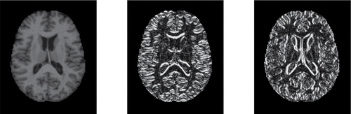 Figure 12. Original MRI image of subject 387, and its derivatives in the horizontal and vertical direction.