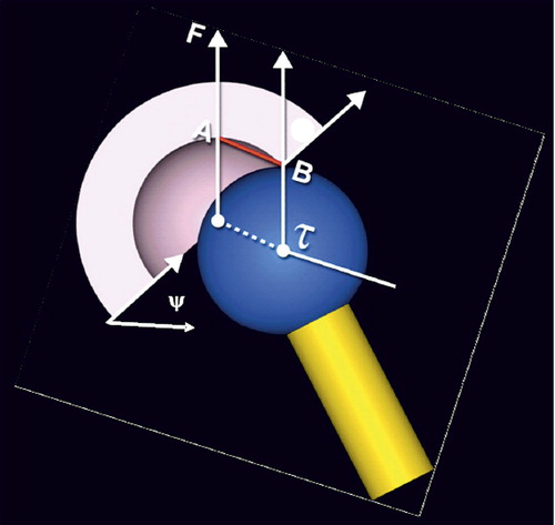 Figure 1. The jumping distance is the lateral translation (AB) of the center of the femoral head (t) before dislocation occurs. F is the load force and y is the planar cup inclination angle measured in the frontal plane.