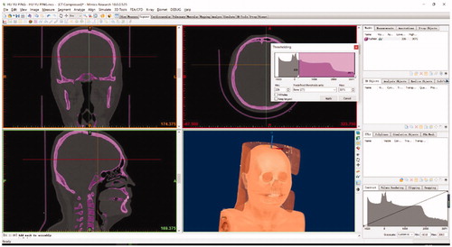 Figure 2. Set the thresholding value. When the CT scan file is uploaded, we select Menu bar > Segmentation > Thresholding, and, for the data, we set the minimum value as 226 (Bone(CT)) to get the required part of the skull model. The thresholding result is saved as a new mask automatically.